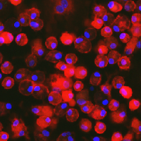 M2 macrophages